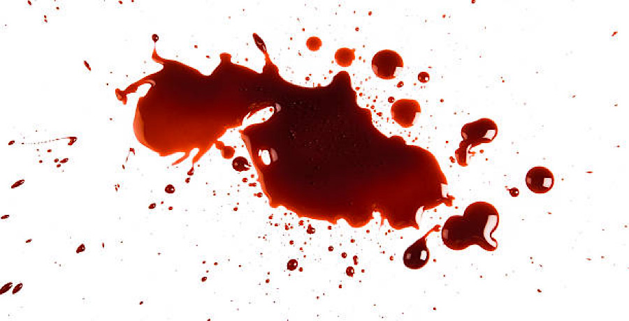 Country Superstar Left With Bloodied Face, Fan Tosses Item